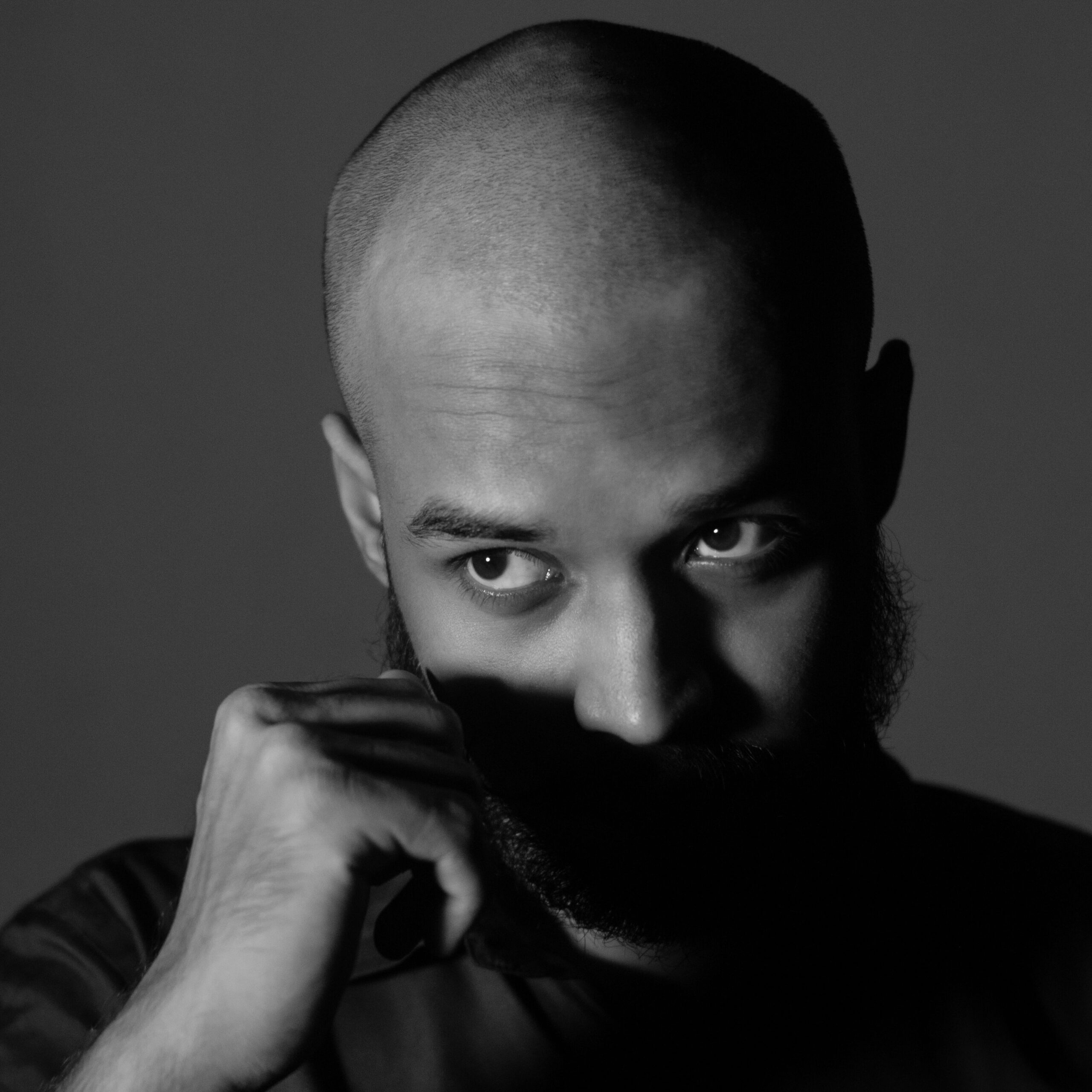 how to stop alopecia areata from spreading